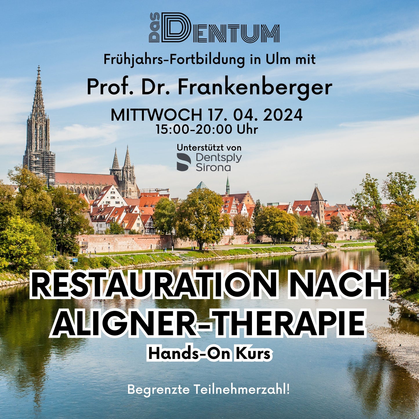 Direkte und indirekte Restauration nach Aligner-Behandlung mit Hands-On